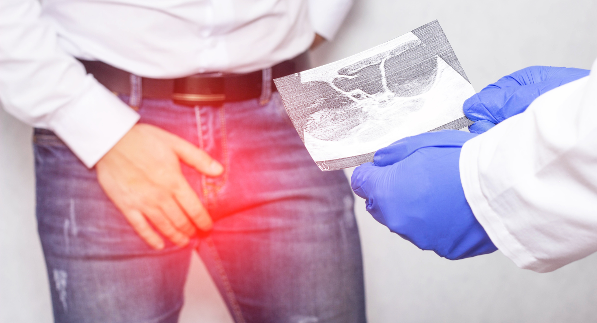 Varicocele: Um Inimigo Invisível na  Infertilidade Masculina! Veja os Sintomas.